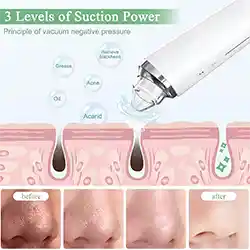 تمیز کننده قوی منافذ صورت با دوربین 